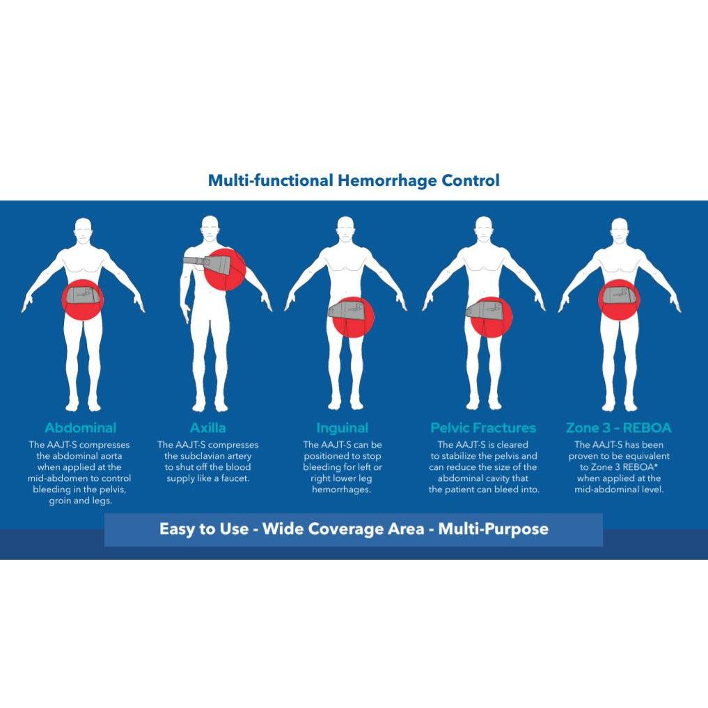 Abdominal and Aortic Junctional Tourniquet – Stabilized (AAJT-S)-Integrated MedCraft