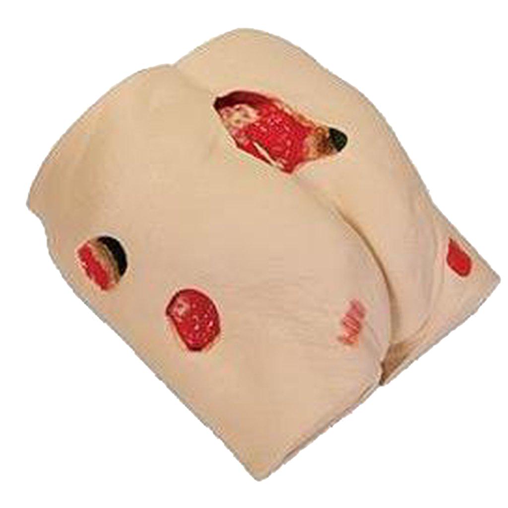 Decubitus Wound Care Model-Integrated MedCraft