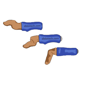 Dislotech™ Finger Joint Reduction Trainer-Integrated MedCraft