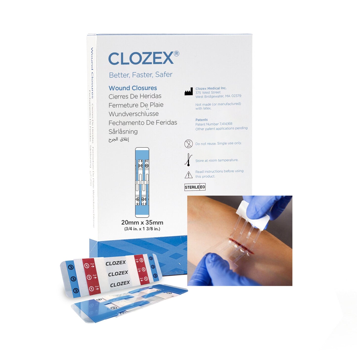 Clozex Skin Closure Device, Small, 20mm, Box/10