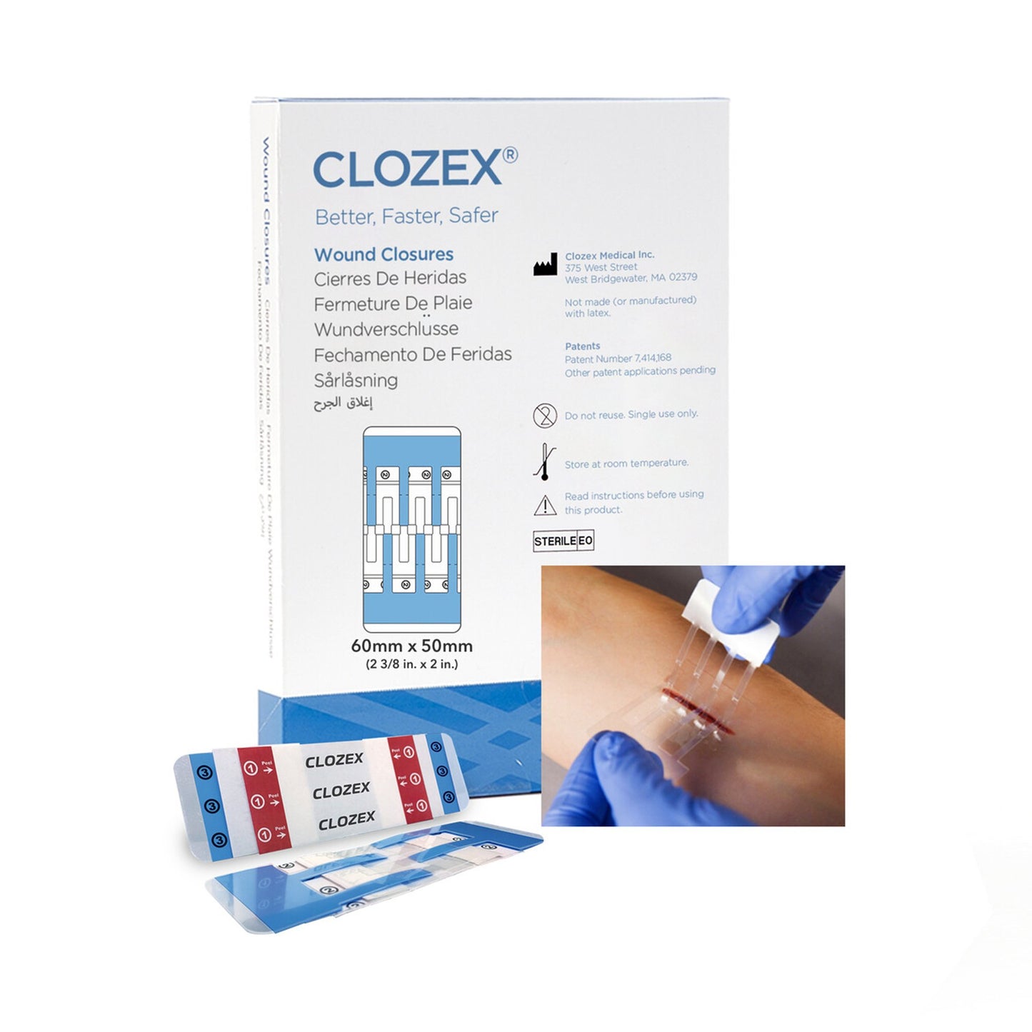 Clozex Skin Closure Device, Large, 60mm, Box/10