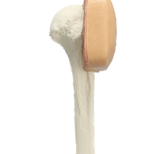 Humerus with skin patch, EA-Integrated MedCraft