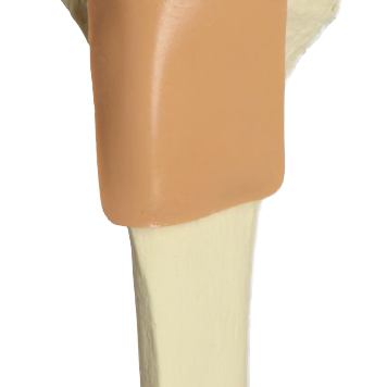 Tibia with Skin Patch, Proximal, EA-Integrated MedCraft